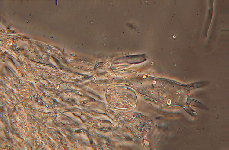 Aleurodiscus amorphus (Fr.)Schroeter